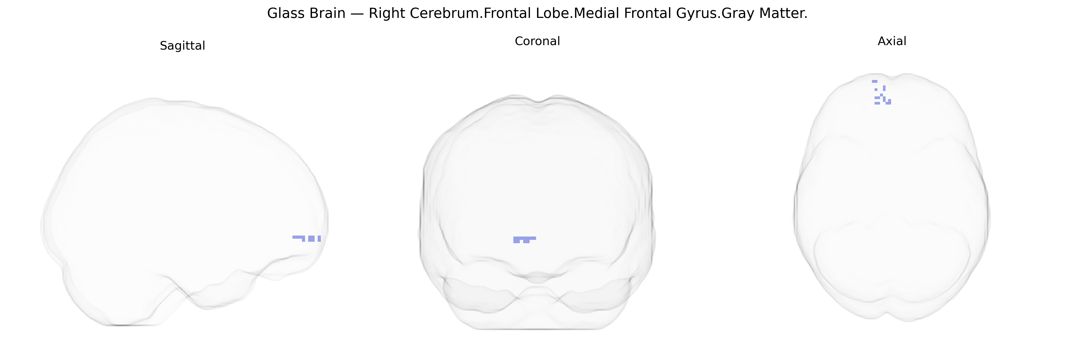 Triplanar Ghost Brain