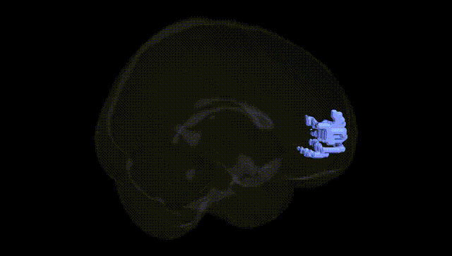 Full Brain Black