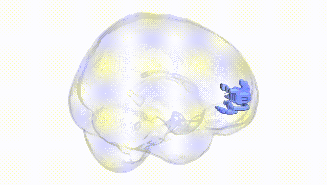 Full Brain White
