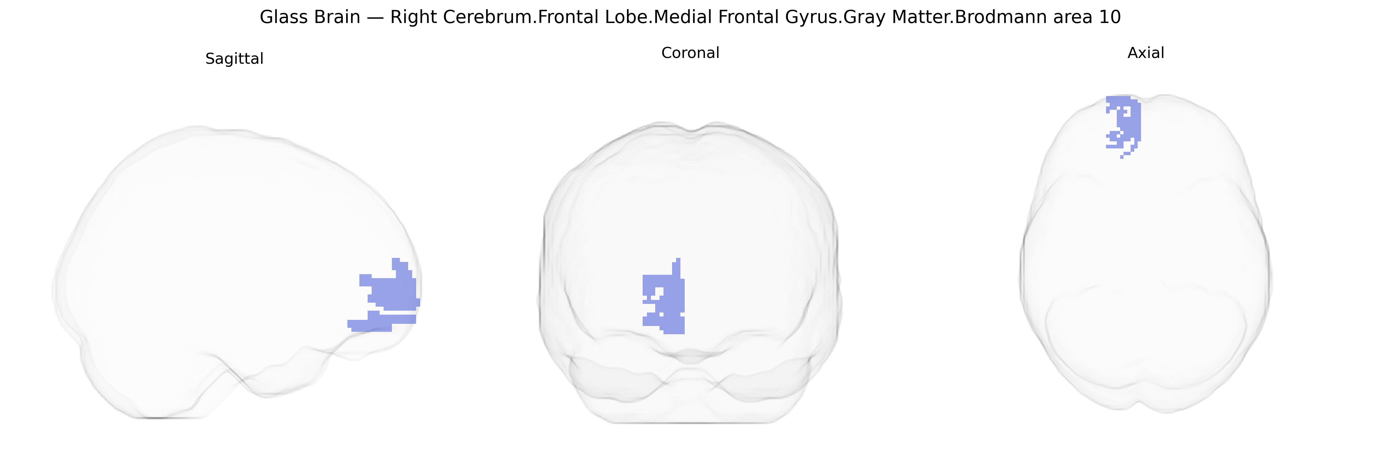 Triplanar Ghost Brain