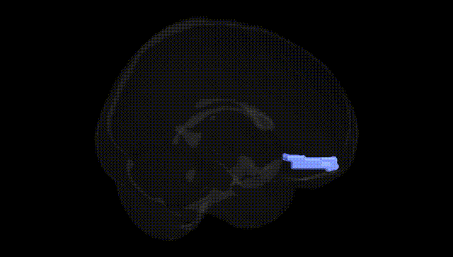 Full Brain Black