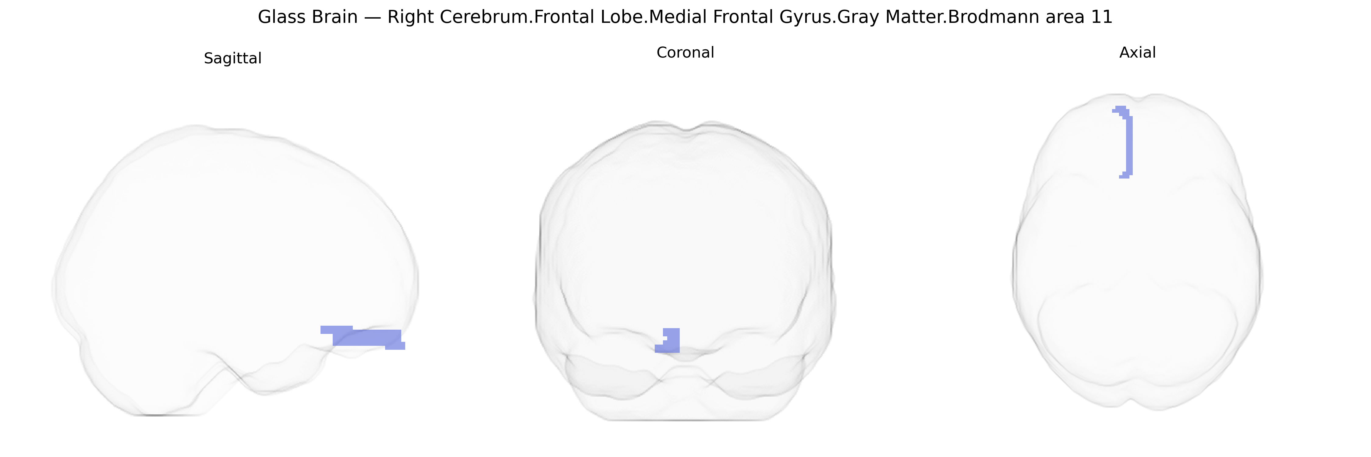 Triplanar Ghost Brain