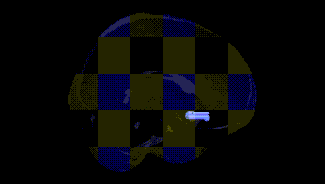 Full Brain Black