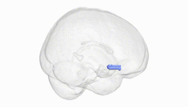Full Brain White