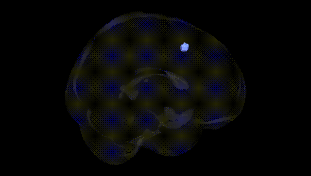 Full Brain Black