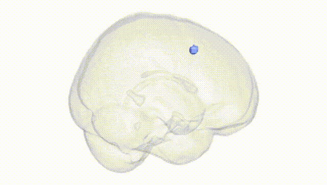 Full Brain White