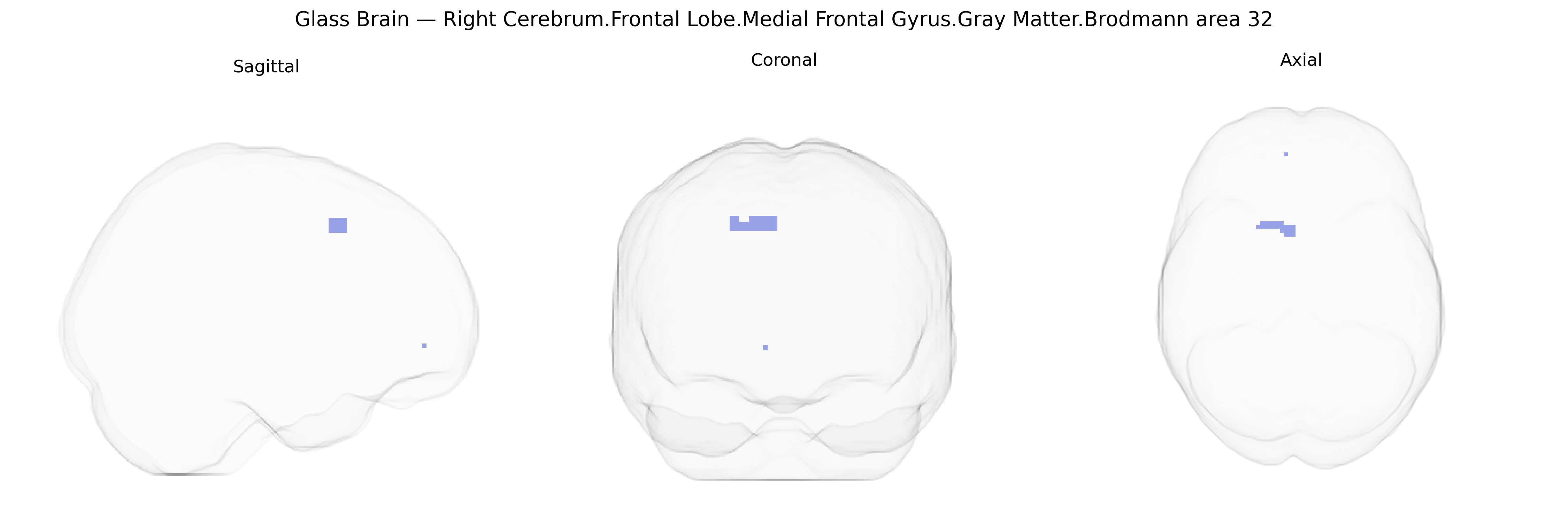 Triplanar Ghost Brain
