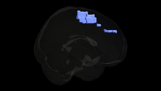 Full Brain Black