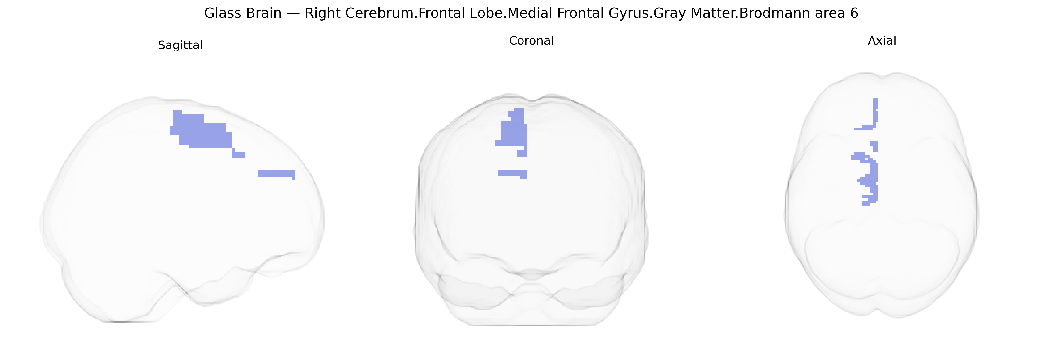 Triplanar Ghost Brain