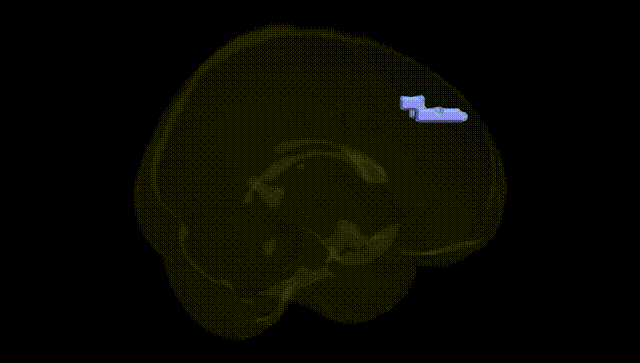 Full Brain Black