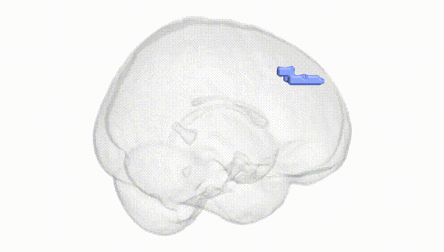 Full Brain White