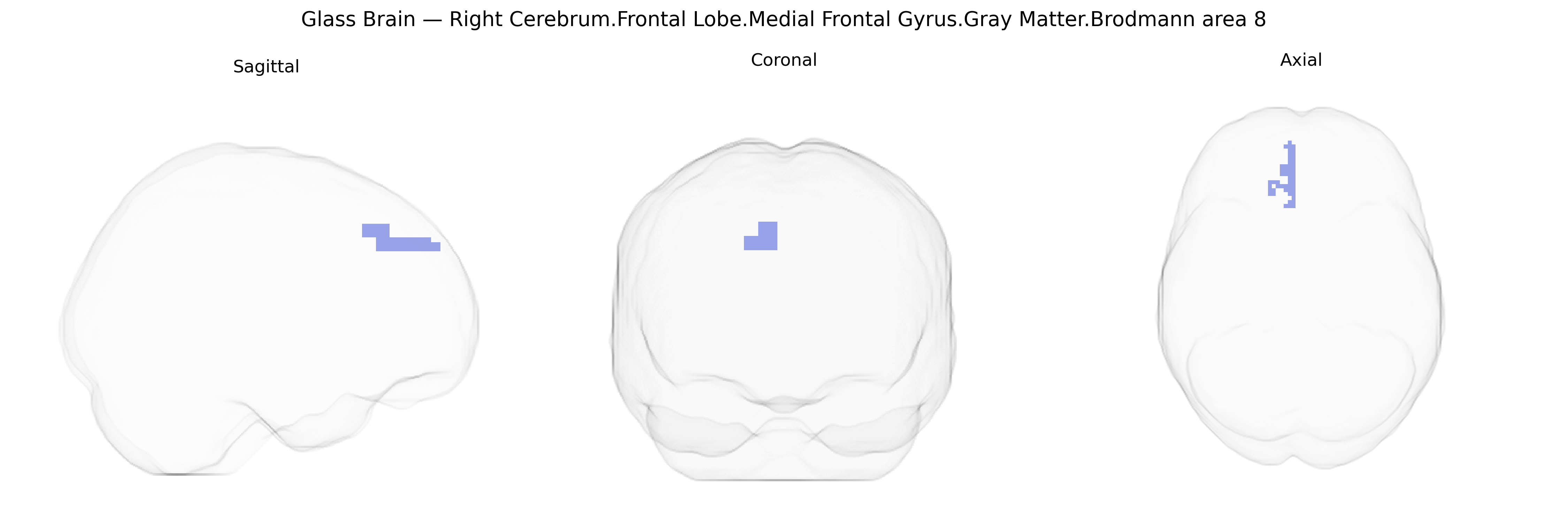 Triplanar Ghost Brain