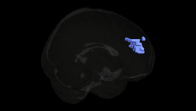 Full Brain Black