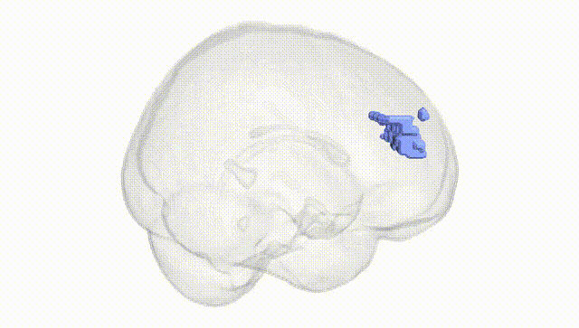 Full Brain White
