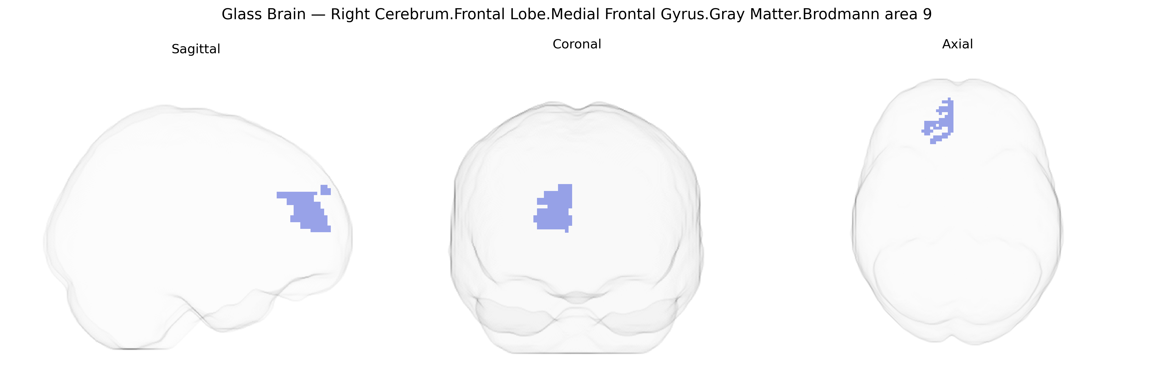 Triplanar Ghost Brain
