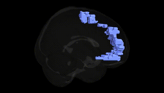 Full Brain Black