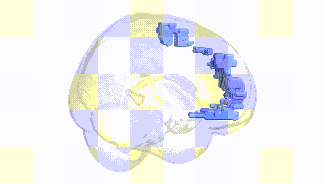 Full Brain White