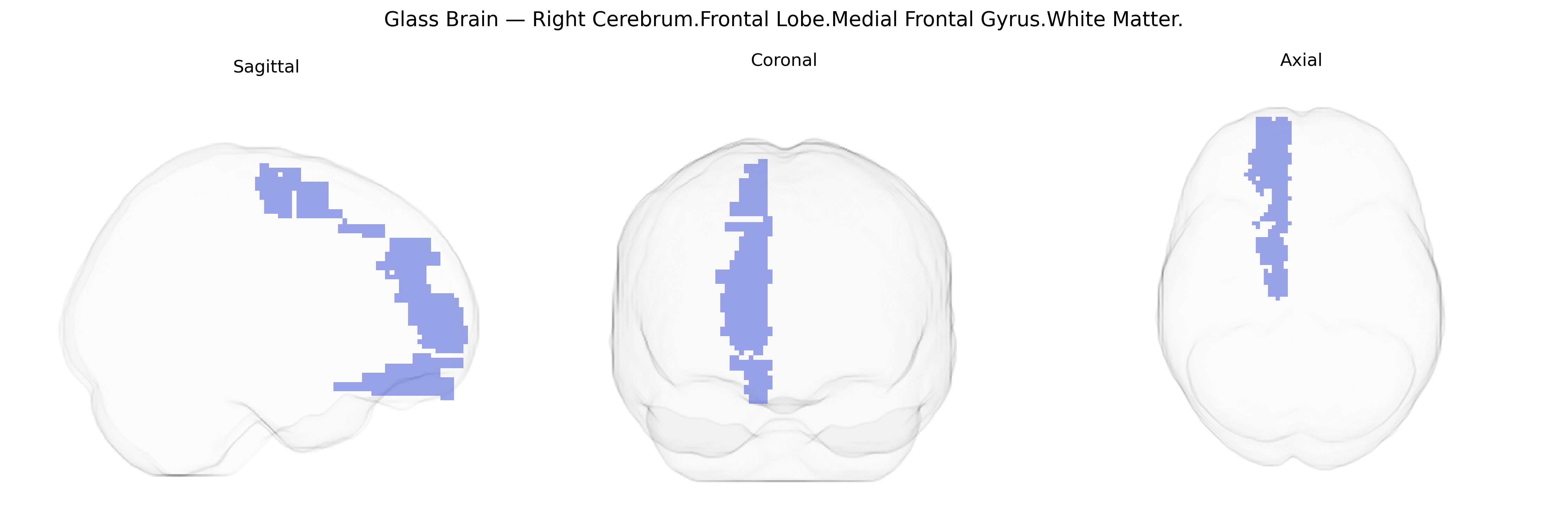 Triplanar Ghost Brain