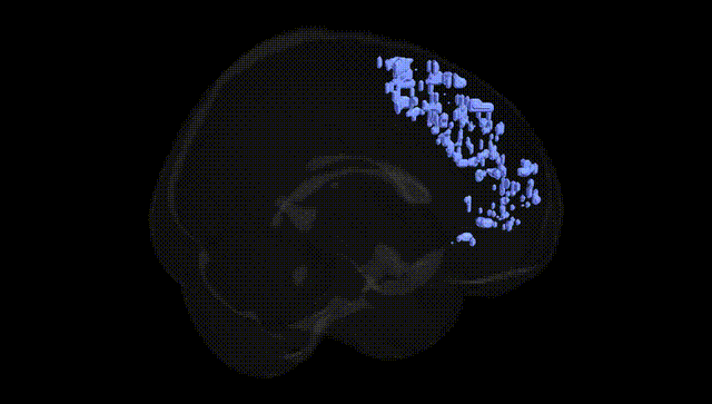 Full Brain Black
