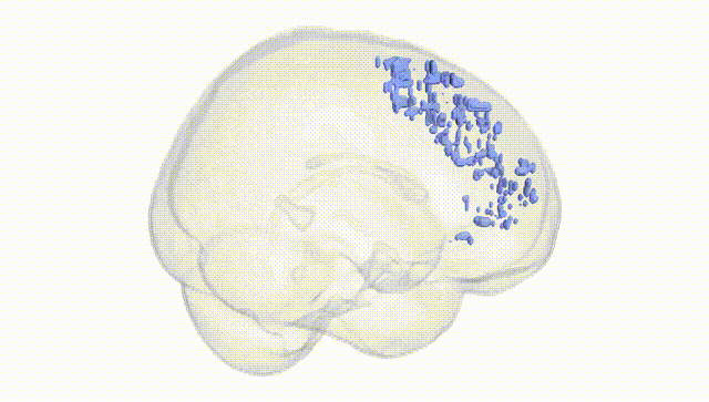 Full Brain White