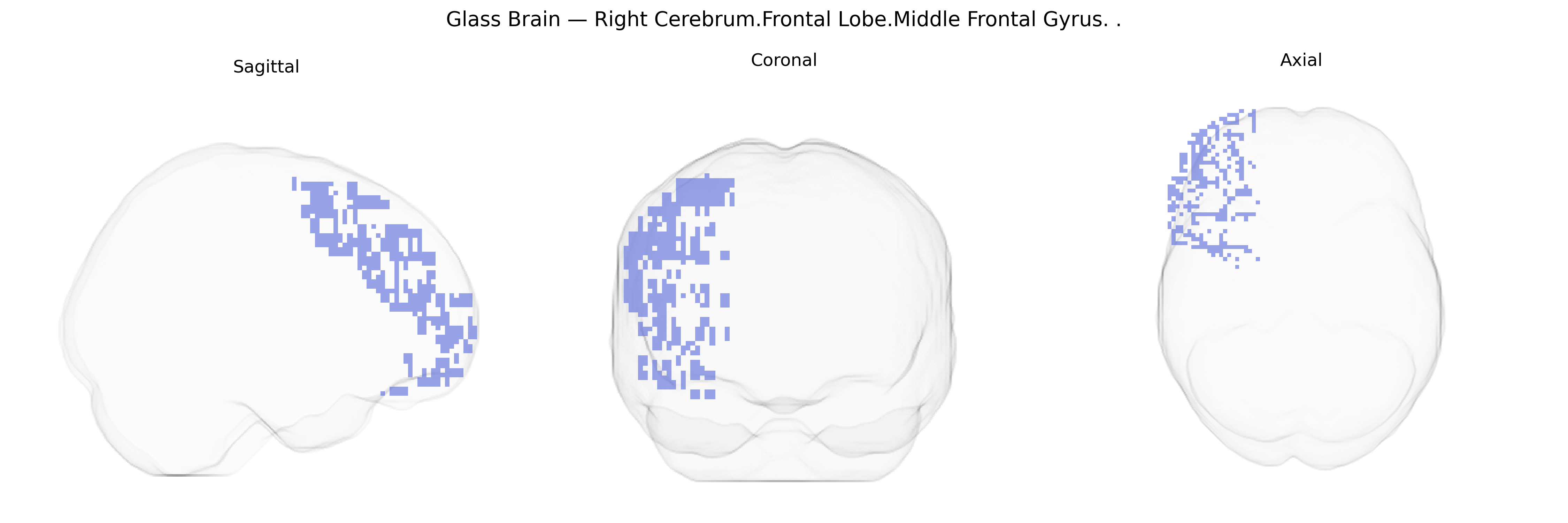 Triplanar Ghost Brain