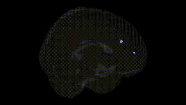 Full Brain Black