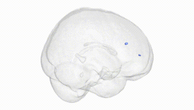 Full Brain White
