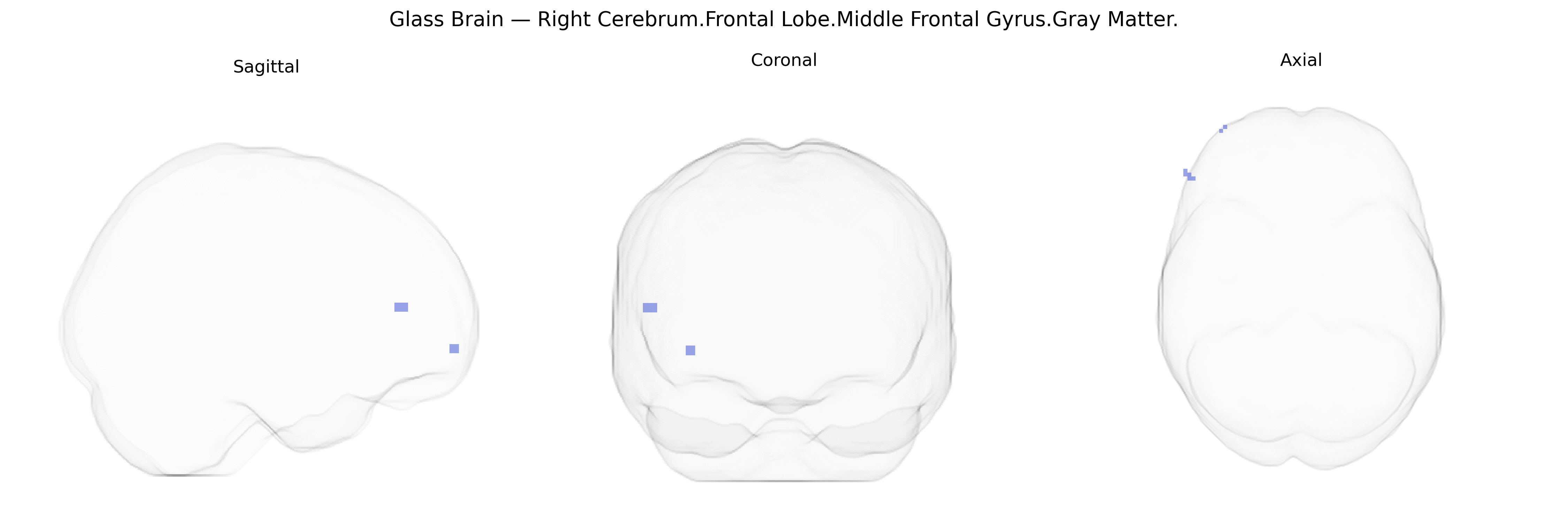 Triplanar Ghost Brain