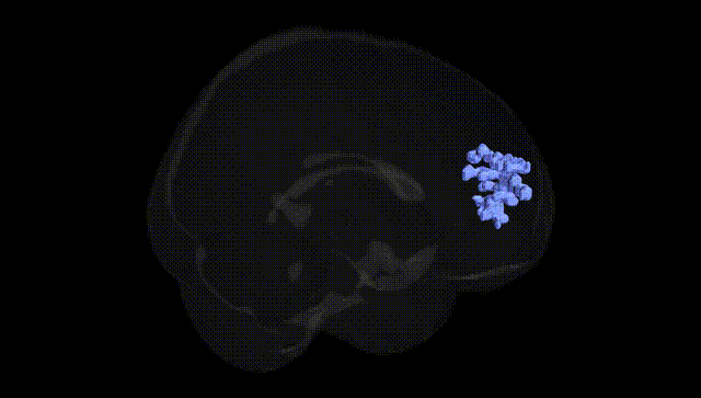Full Brain Black