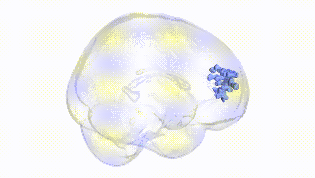 Full Brain White