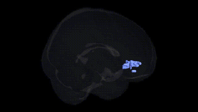Full Brain Black