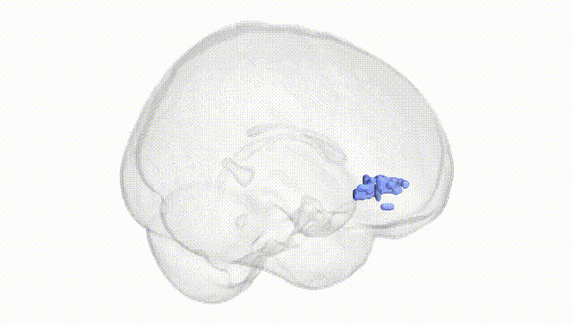 Full Brain White