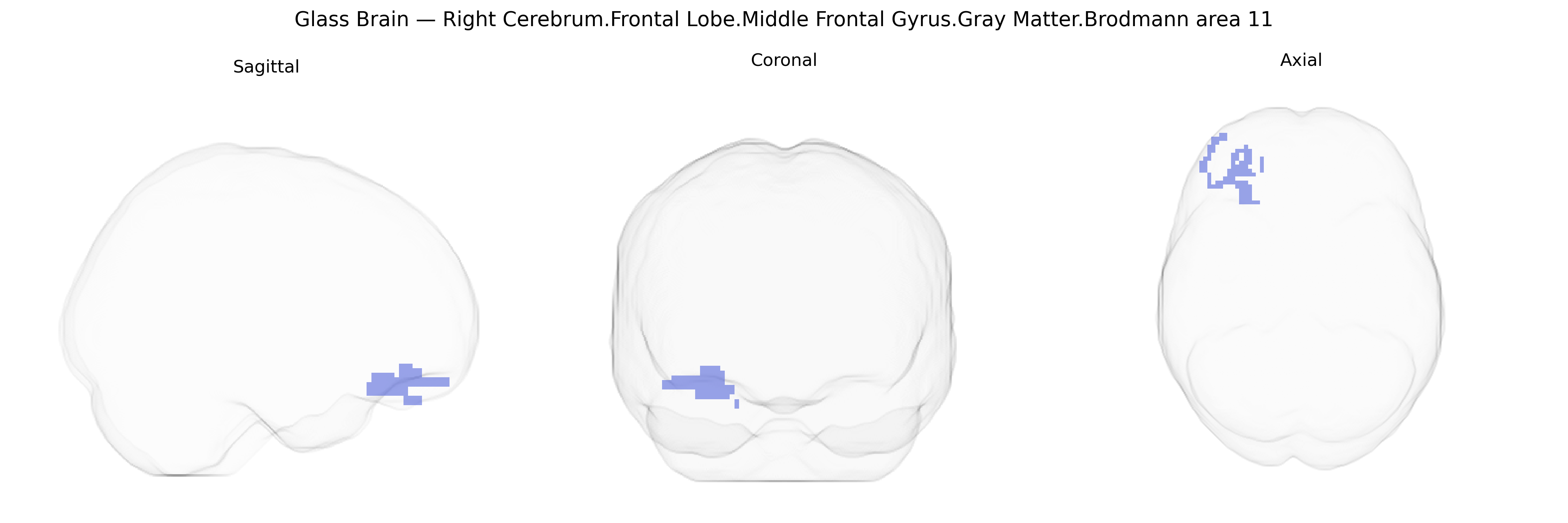 Triplanar Ghost Brain