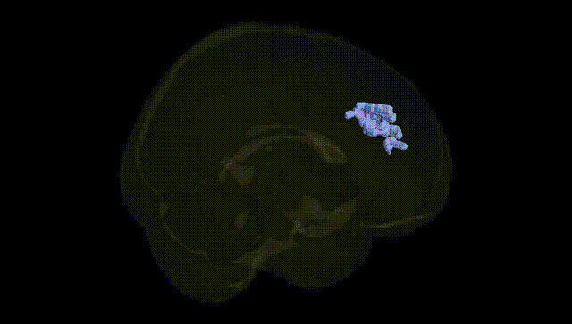 Full Brain Black