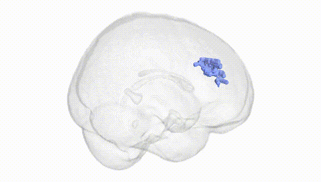 Full Brain White