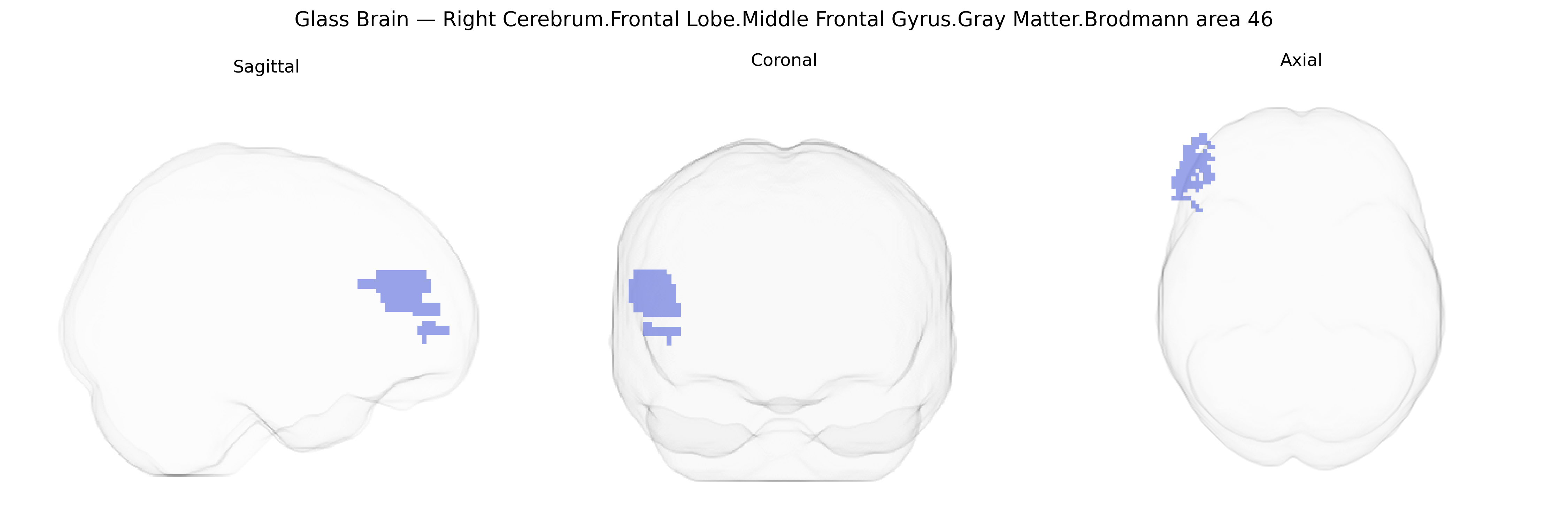 Triplanar Ghost Brain