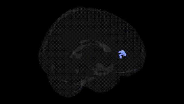 Full Brain Black