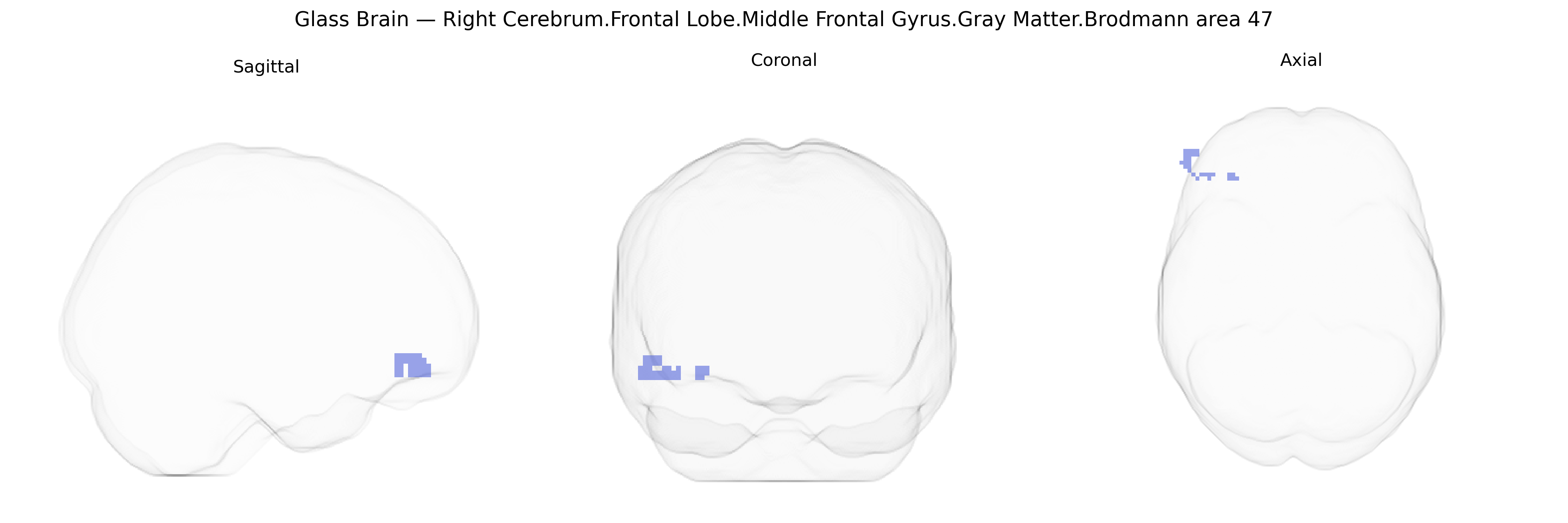 Triplanar Ghost Brain
