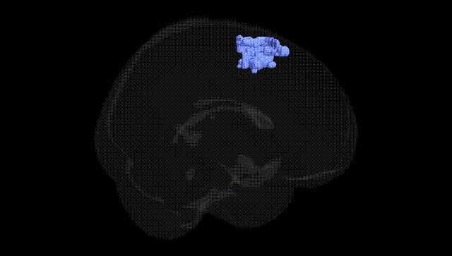 Full Brain Black
