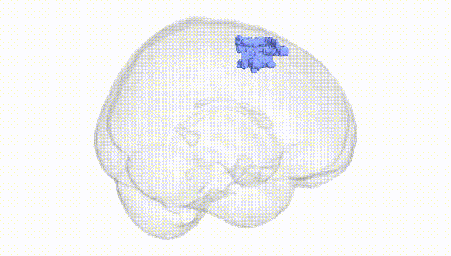 Full Brain White