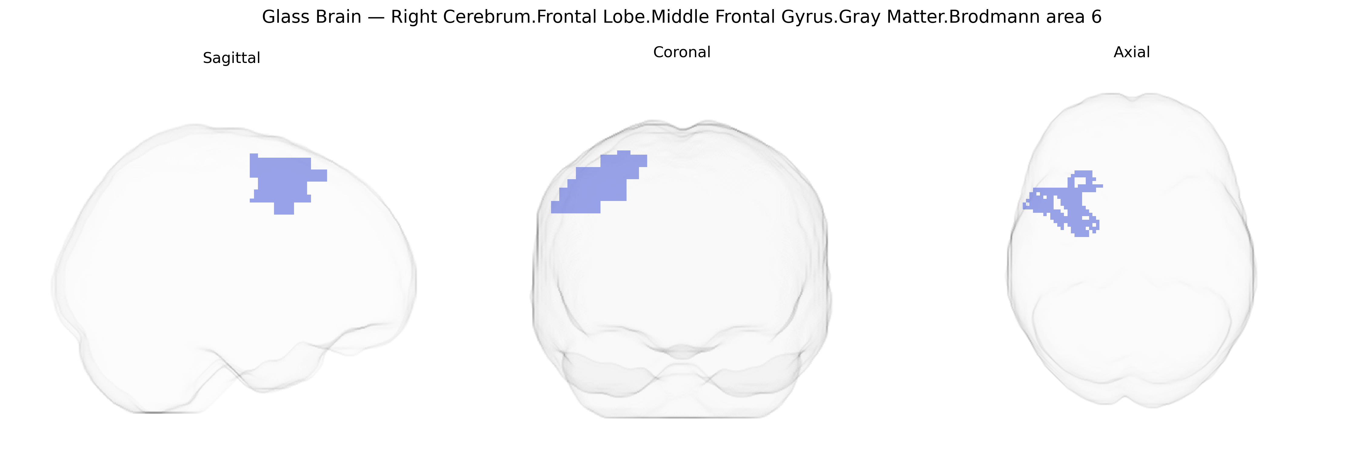 Triplanar Ghost Brain