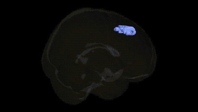 Full Brain Black