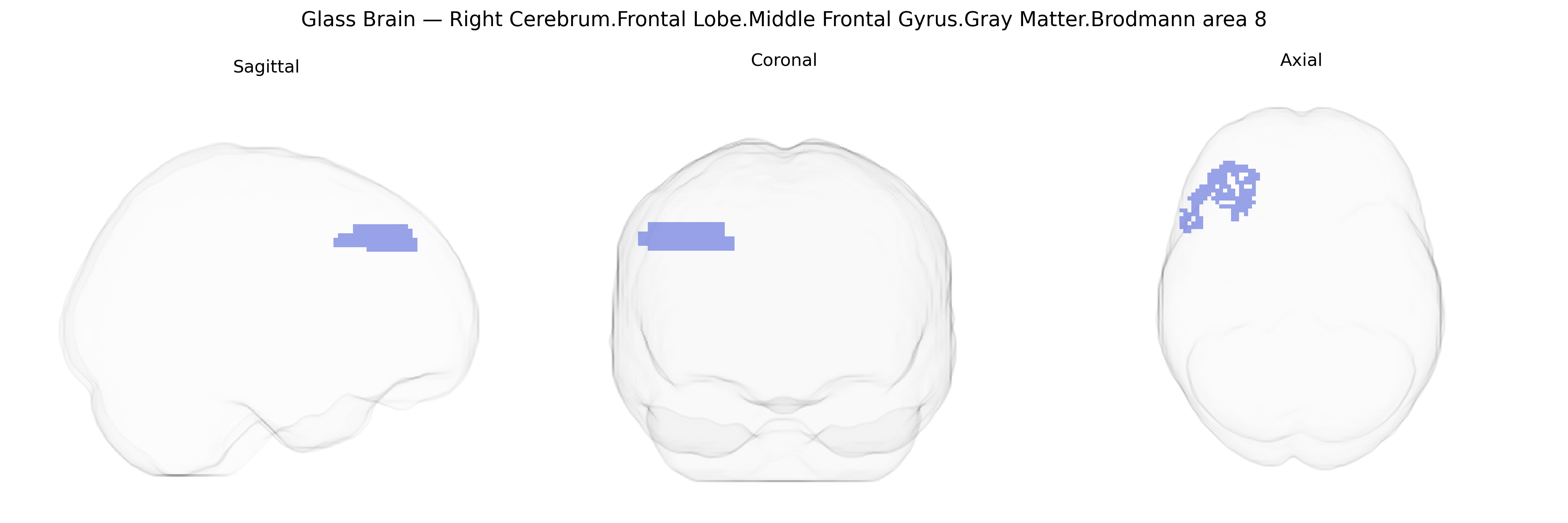 Triplanar Ghost Brain
