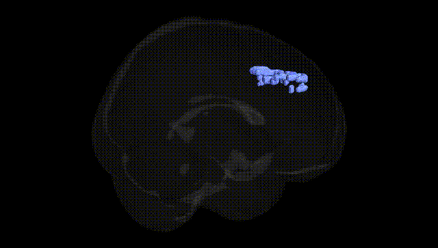 Full Brain Black