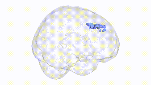 Full Brain White