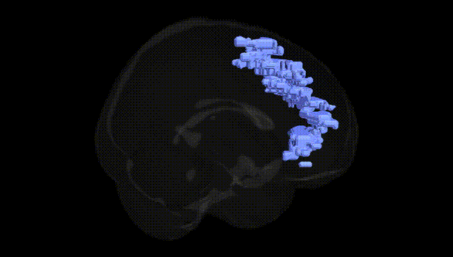 Full Brain Black