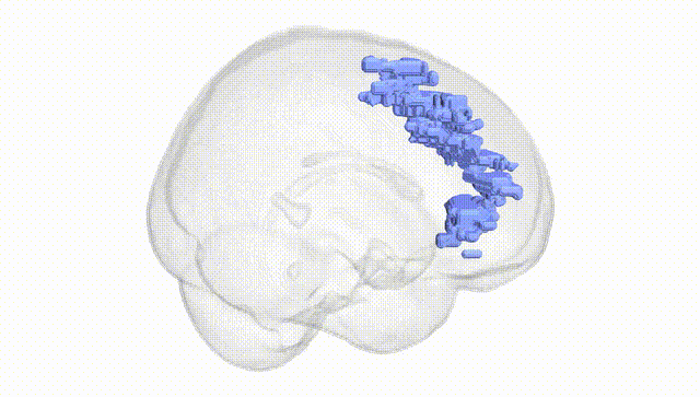 Full Brain White