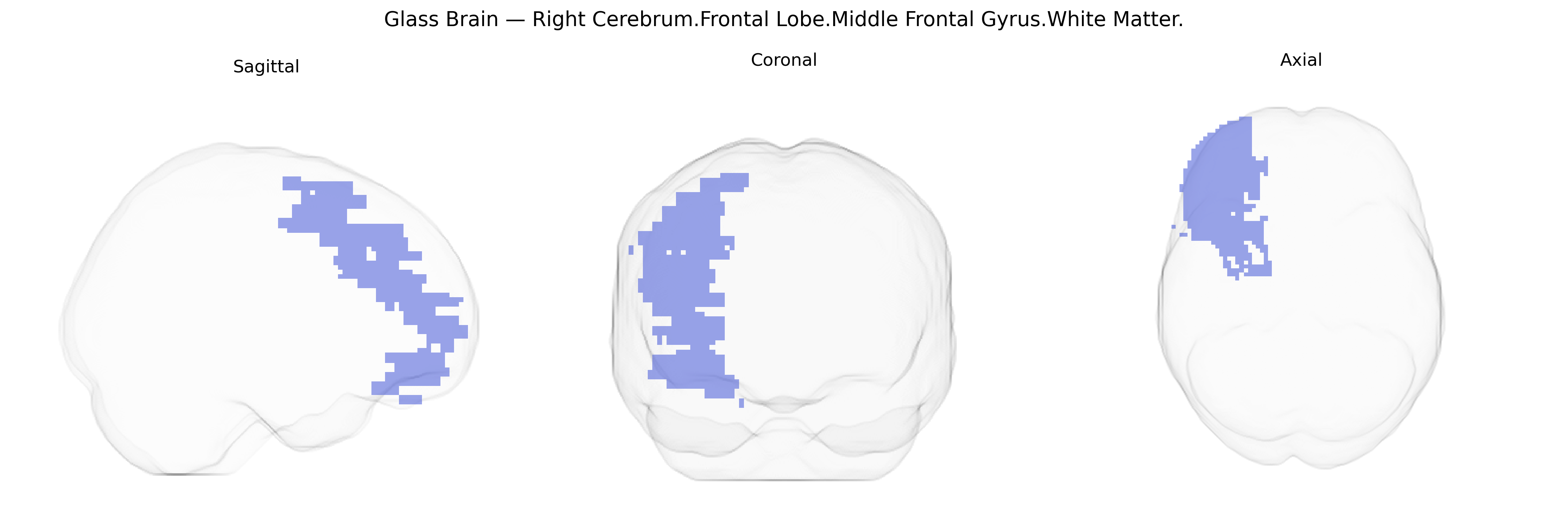 Triplanar Ghost Brain