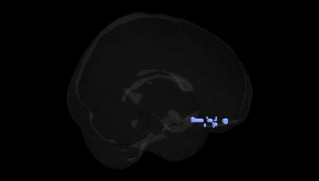 Full Brain Black