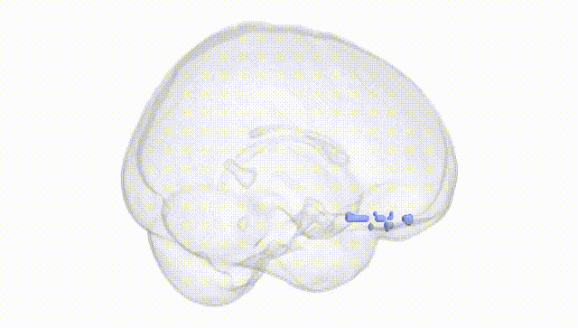 Full Brain White